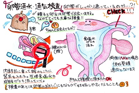 通水・通期検査のイラスト